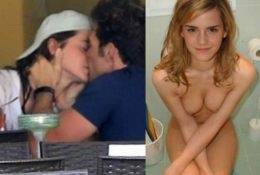 Emma Watson Nude Photos With Her Boyfriend Leaked! on galpictures.com