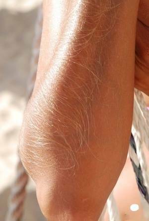 Amateur model Lori Anderson shows her hairy arms in a bikini and sunglasses on galpictures.com