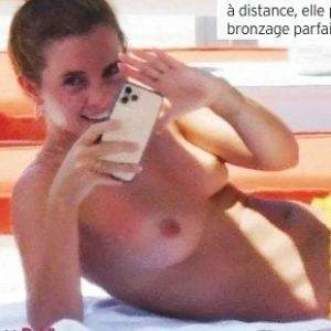 Delphine EMMA WATSON TOPLESS NUDE SUNBATHING PHOTOS PUBLISHED IN FRANCE - France on galpictures.com